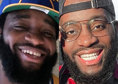 candid-pro-invisible-liners-radiant-smiles-tucson-before-after-photo-10