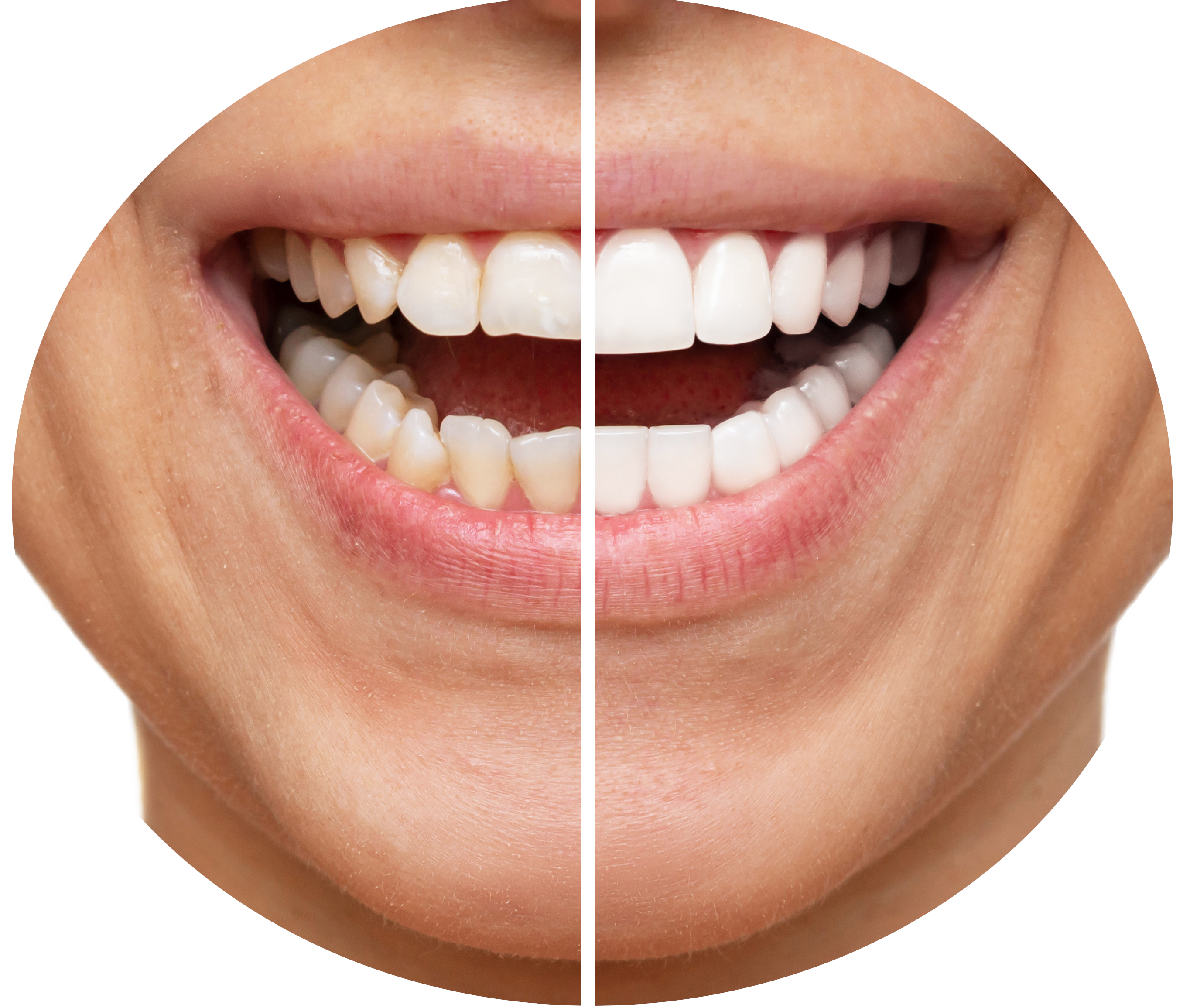 tucson-emergency-dentist