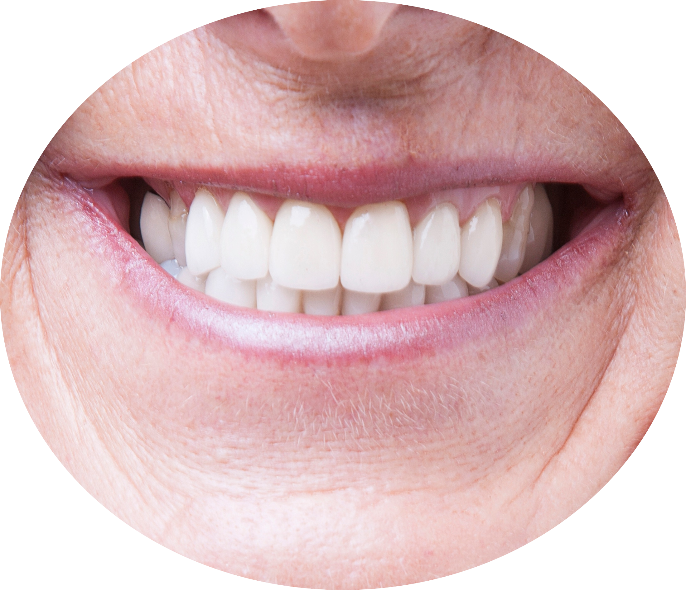 dentures