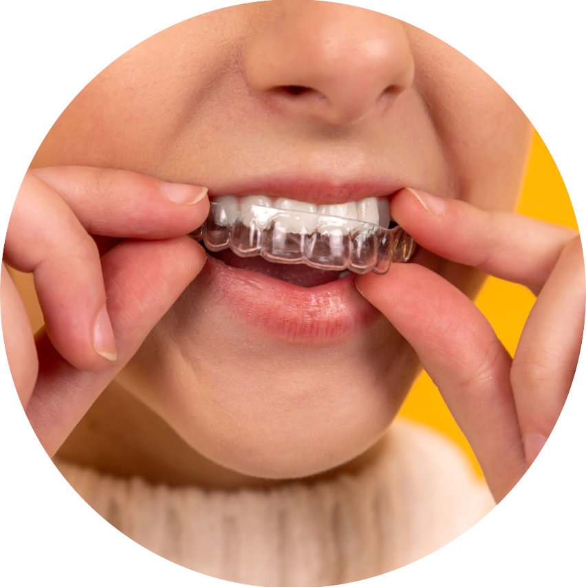 Invisible-teeth-aligner-tucson